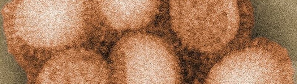 Die Spanische Grippe war ein Influenzavirus (H1N1).