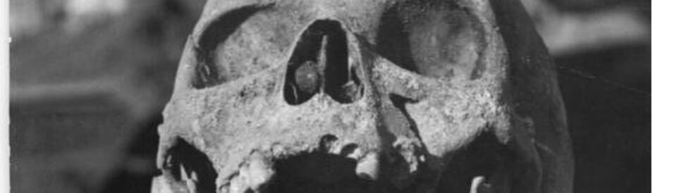 Berliner Schädelfund aus der Zeit von 1347 bis 1353.